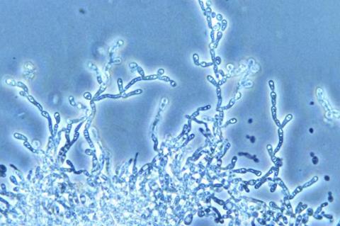 Saccharomyces cerevisiae yeast