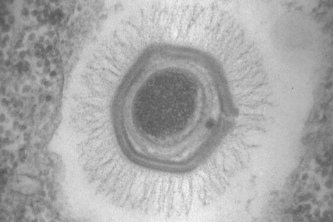 F21-02-9780123846846_mimivirus_particle_internals