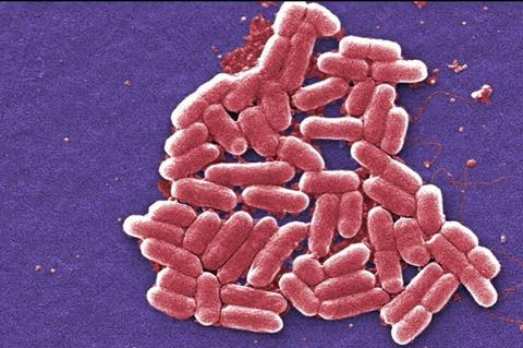 Escherichia_coli_electron_microscopy