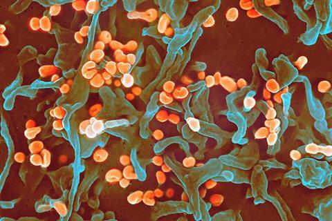 Lassa_virus_budding_off_a_Vero_cell