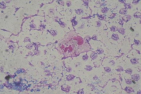 Pseudomonas_aeruginosa_smear_Gram_2010-02-10
