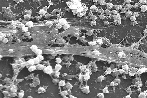 Staphylococcus_aureus_biofilm_01