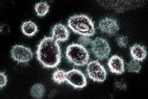 Novel_Coronavirus_SARS-CoV-2_(49557785727)