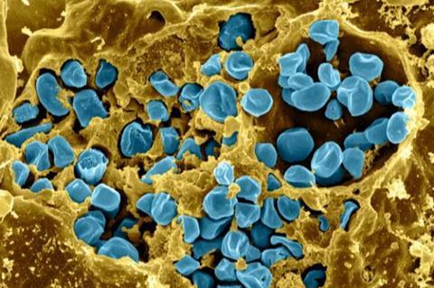 Macrophage_Infected_with_Francisella_tularensis_Bacteria_(5950310835)