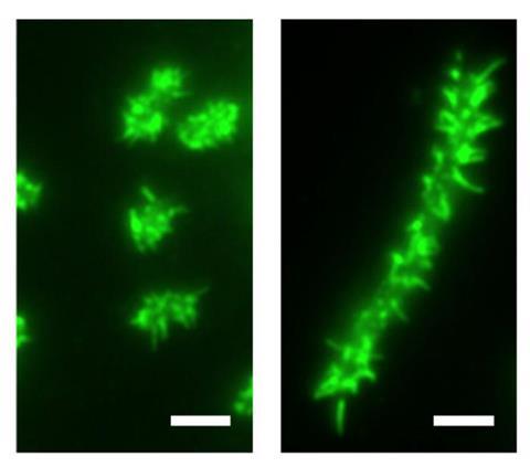 Low-Res_hairy bacteria