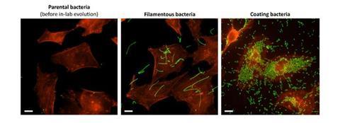 Low-Res_Two distinct patterns of attachment to human cells
