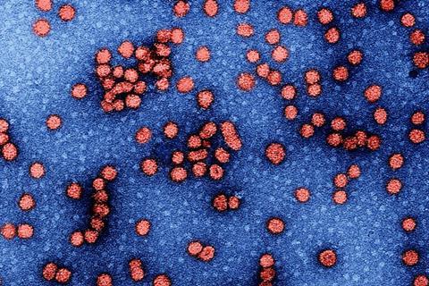 Image of hepatitis B particles