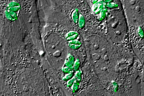 Image of a combination of DIC and epifluorescence of human fibroblasts infected with <i>Toxoplasma gondii</i> transgenic that expresses GFP-tubulin (green).