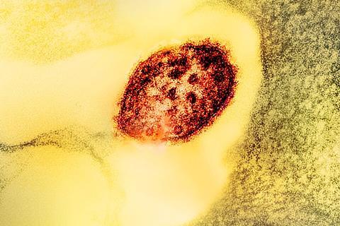 Measles_Virus_Particle