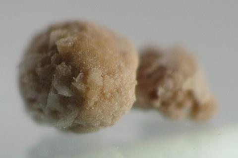 800px-Kidney_stone_4mm_05