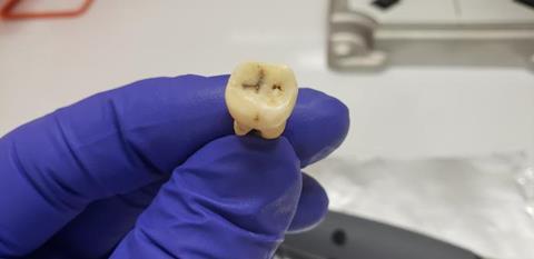 Low-Res_Jerash tooth 2 - May 2022 - Credit Greg O'Corry FAU-Crowe