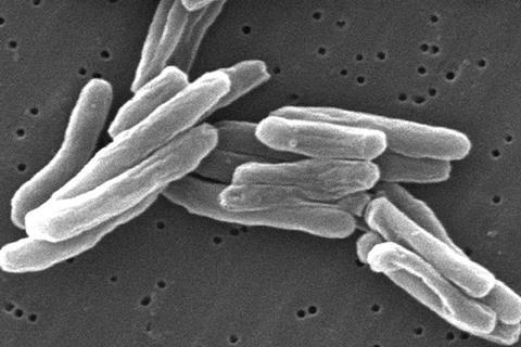 Mycobacterium_tuberculosis (1)