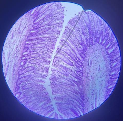 Толстая_кишка