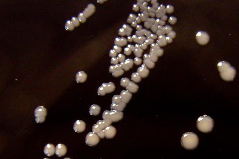 Bordetella_pertussis_on_Charcoal_Agar_supplemented_with_Cephalexin_-_Detail