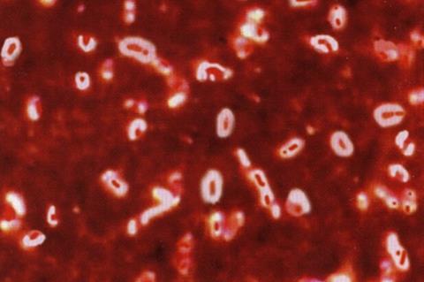 Капсула_Klebsiella_Pneumoniae