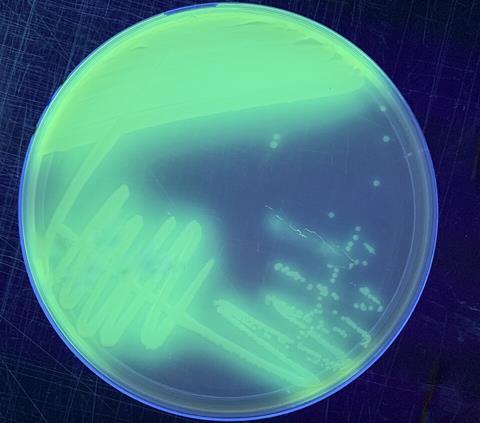 Pseudomonas_putida_on_King's_B_agar_under_UV_light