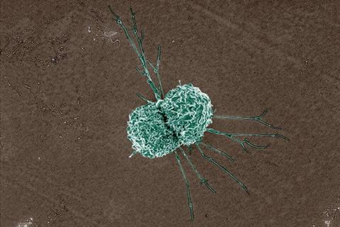 Macrophage_(17195150690)