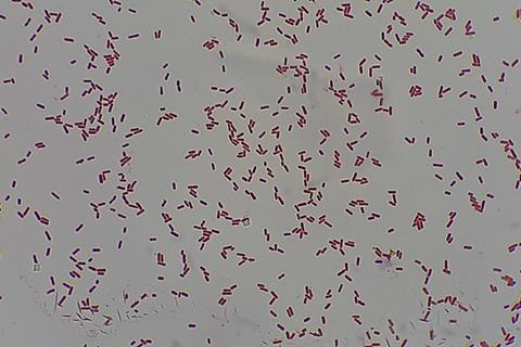 Gram_Negative_bacilli_of_Klebsiella_in_Gram_stained_smear_of_culture (1)