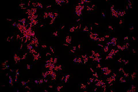 Fluorescent image of <i>Mycobacterium tuberculosis</i>