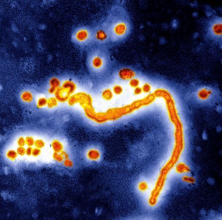 Influenzavirus A, TEM