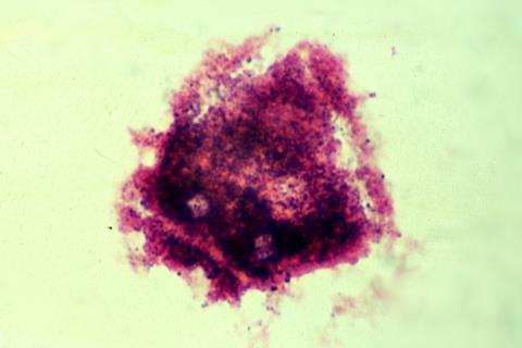 ClueCell_de_vaginose_à_Gardnerella