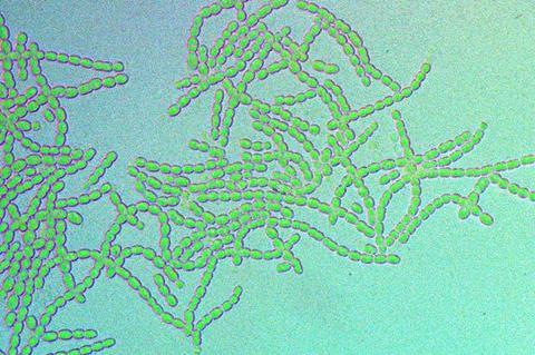 Low-Res_Filamentous cyanobacteria belonging to the species, Nostoc punctiforme. Credit Blair Paul