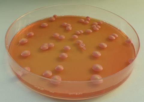 Brettanomyces_plate_01