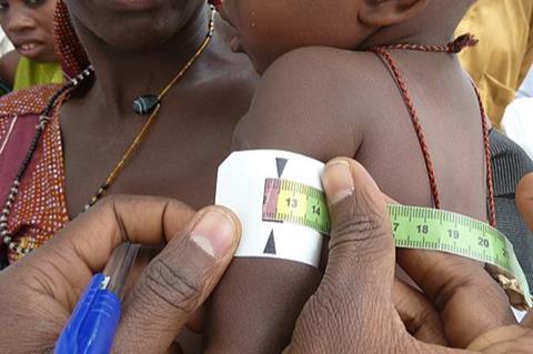 A_child_is_checked_for_signs_of_malnutrition_in_Katsina_State,_Nigeria,_March_2011_(8406367308)