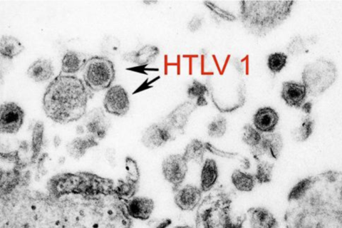 HTLV-1
