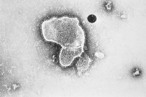 Respiratory Syncytial Virus (RSV)