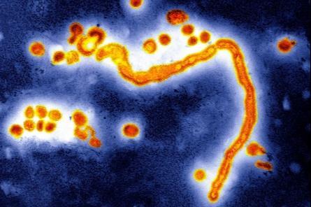 Influenzavirus A, TEM