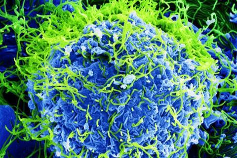 Ebola_Virus_-_Electron_Micrograph.tiff