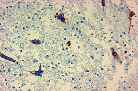 CSIRO_ScienceImage_349_Avian_influenza_in_the_brain_of_a_chicken_embryo