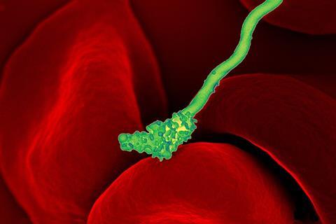 Borrelia_hermsii_Bacteria_(13758011613)