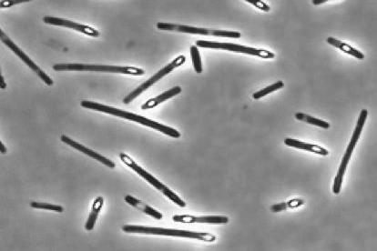 Clostridium_perfringens_sporulating