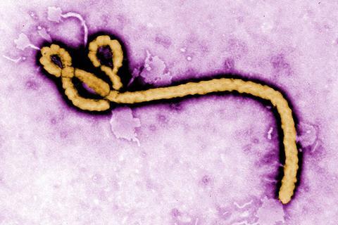Ebola_virus_(2)