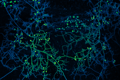Mycelium_of_arbuscular_mycorrhizal_fungi_with_false_color
