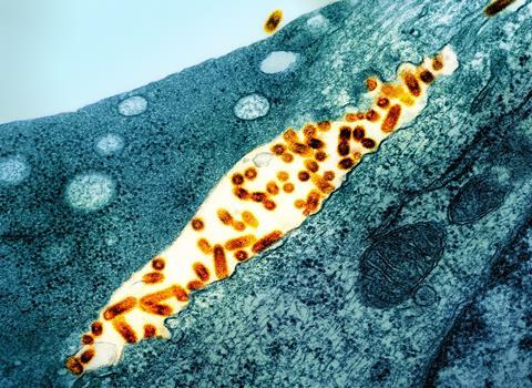 Vesicular_Stomatitis_Virus_(VSV)_particles_(orange)_found_in_extracellular_space_and_budding_from_the_plasma_membrane_of_infected_cells_(teal)