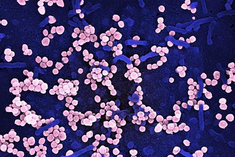 Lassa_Virus_-_51692120370