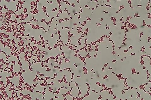 Gram_-negative_cocci_(GNC)_and_Gram_-negative_rod_(GNR)_of_Acinetobactet_baumannii_in_Gram_staining