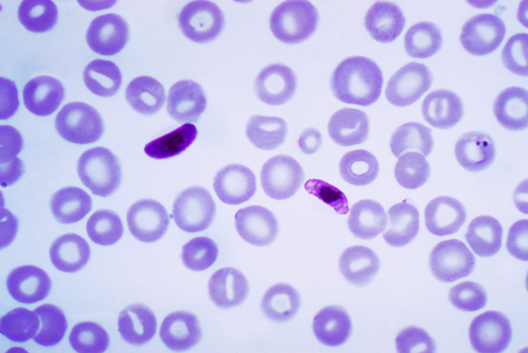 Plasmodium_falciparum_01