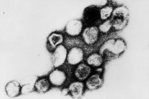 Rubella_virus_TEM_B82-0203_lores (1)