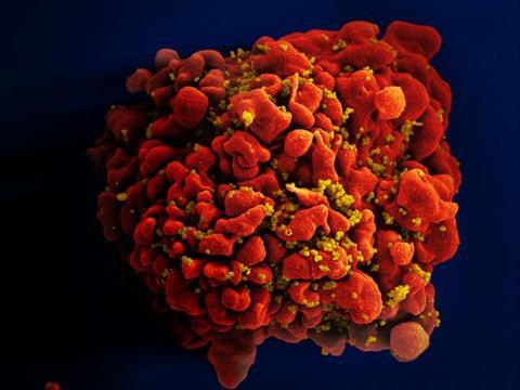 HIV-infected_H9_T_Cell_(6813314147)