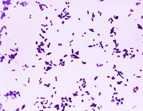 Gram_stain_of_Streptococcus_pneumoniae