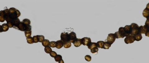 Low-Res_melanized hyphae developing into chlamydospores(1)