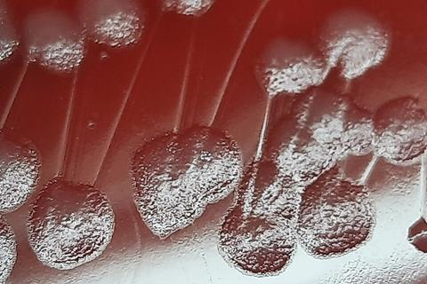 Pseudomonas_aeruginosa_colony_morphology_on_blood_agar