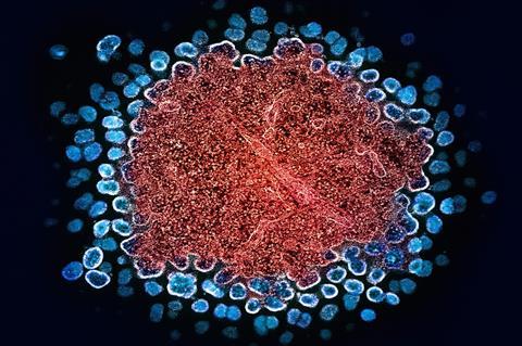 national-institute-of-allergy-and-infectious-diseases-8J7X8DsAIYs-unsplash