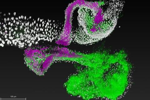 Low-Res_CSWF-CF Foregut 3 with autofluorescence-4 (1)