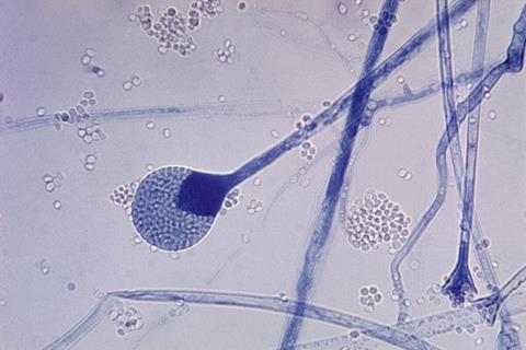 Mature sporangium of a Mucor sp. fungus