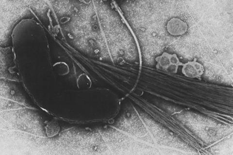 735px-Vibrio_cholerae (1)